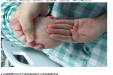 中西医结合重症医学联盟