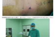 脊柱外科疾病诊治联盟