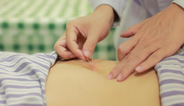 【特色壮医】五次治疗封印“社交尴尬”，壮医综合疗法让产后尿失禁按下“暂停键”！